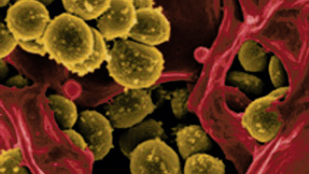 MT Nov 2014 best of blog