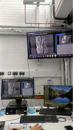 Three computer screens, two with a microscopic image