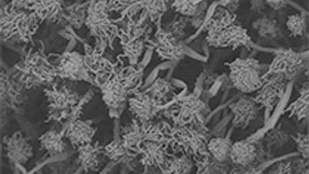 Microscopic image of grey-coloured microbes.