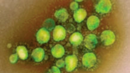 MT Aug 2013 MERS Coronavirus