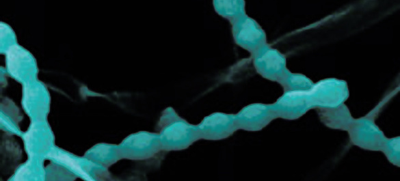 Blue abstracts beaded strings on a black background