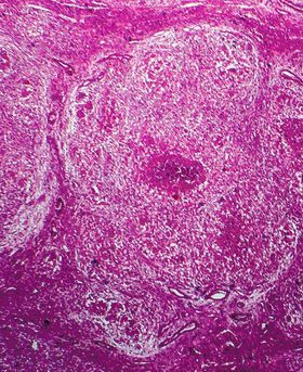 Microscopic image of a purple cell.