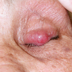 MT Feb 2013 5 Hindle Merkel