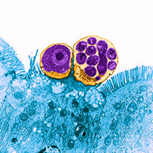Microscopic image of parasitic protozoa attached to a host's intestinal lining, viewed under a colour-enhanced electron microscope