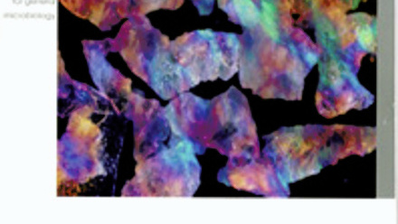 Cover of Microbiology Today, issue of November 2007