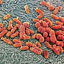 Microscopic image of multiple orange-coloured cells.