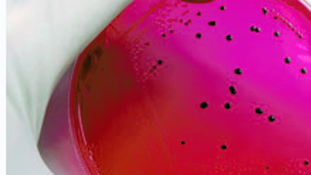 MT Aug 2013 Petri dish