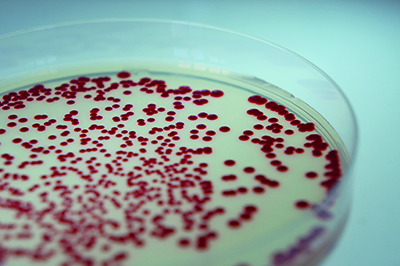 Petri dish with red sample.