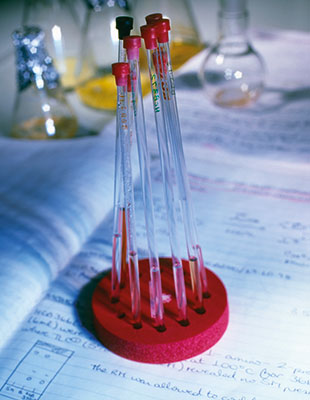 Multiple tube samples in a lab.