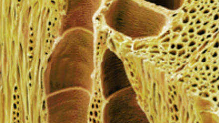 MT Feb 2016 ashes xylem