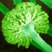 MT Nov 2013 Aspergillus