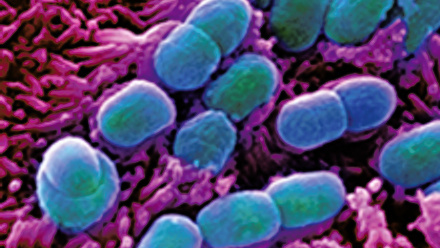 MT Nov 2016 AMR E coli