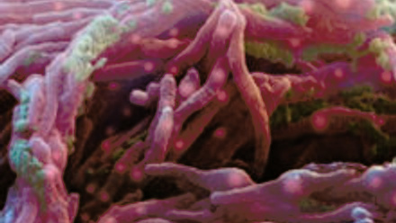 MT Aug 2014 Myco TB insensitive