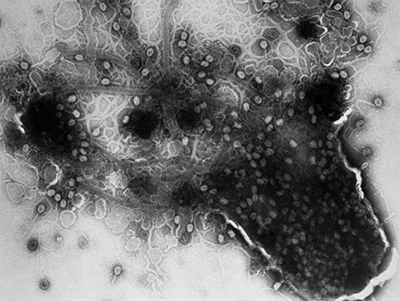 Black and white microscopic image of cells.