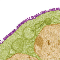 MT Feb 2013 VSV particles (purple) budding from a cell (green))