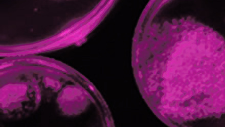 Piece of Access Microbiology cover, with abstract purple shapes in a dark background