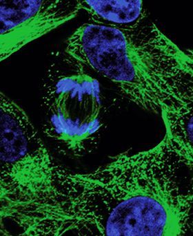 Microscopic image showing multiple cells on a dark background.