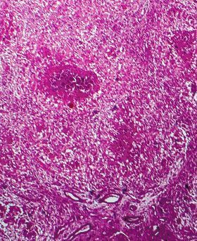 Close up microscopic image of a pink cell.