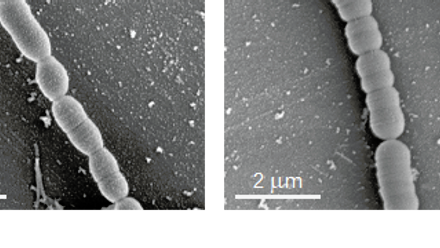 IJSEM IBD microbes.png