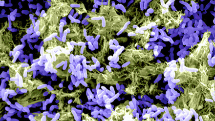 Microscopic image of Pseudomonas aeruginosa biofilms.