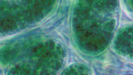 MT Aug 2015 origins of choroplasts glaucocystis