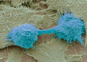 MT Feb 2013 McKeating C0148937