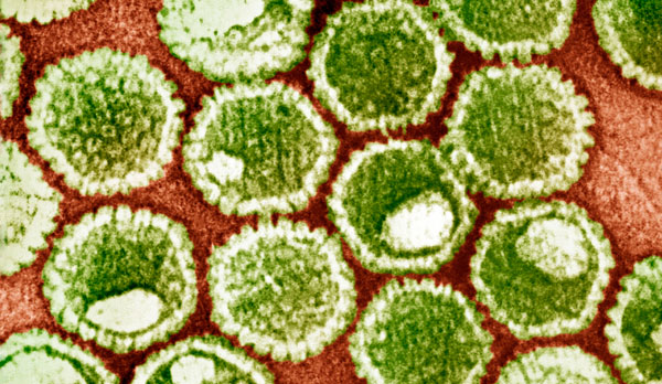 MT Feb 2014 Herpes virus particles