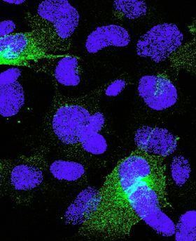 Microscopic image showing multiple blue stains on a dark background.